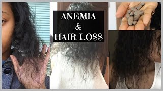 Anemia amp Hair Loss My Story and Recovery [upl. by Esylle]