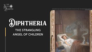 Feature Diphtheria [upl. by Nisbet]