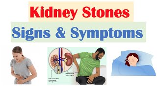 Nephrotic Syndrome 101  Signs Symptoms Pathophysiology  National Kidney Foundation [upl. by Hemphill]