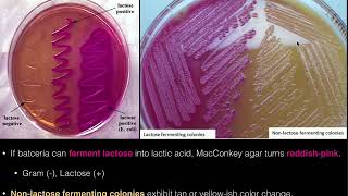 MacConkey Agar [upl. by Silvie]