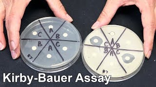 Kirby Bauer Assay  Techniques Demonstration [upl. by Gilburt]