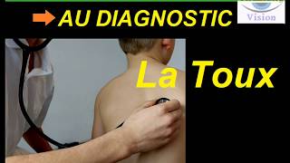 Toux Chronique Chez l’Adulte du Symptômes au Diagnostique [upl. by Acsehcnarf]