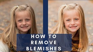 How to Remove Blemishes in Lightroom [upl. by Werra241]