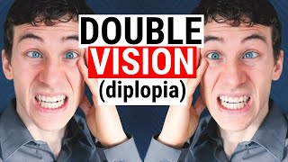 Diplopia and Double Vision  What Causes It and How is it Treated [upl. by Traver]