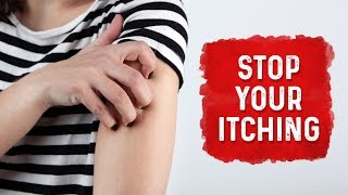 What Causes Hives and Itchiness  Urticaria Hives Treatment  Dr Berg [upl. by Sotsirhc597]