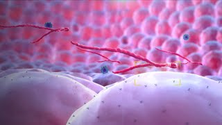 Ebola Virus  Mechanism of Action  3D Medical Animation [upl. by Adnoval]