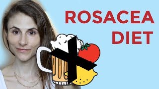 ROSACEA DIET FOODS SUPPLEMENTS PROBIOTICS DR DRAY [upl. by Alhak]