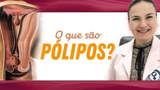 O que são PÓLIPOS [upl. by Stern]