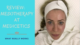 Review of Mesotherapy treatment at Medicetics clinic [upl. by Smaj]