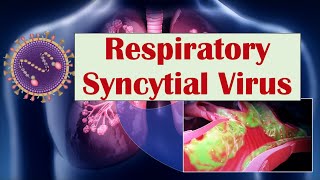 Respiratory Syncytial Virus RSV  What Is It amp What Conditions Does it Cause ex Croup [upl. by Cornie]