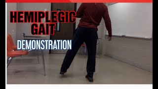 HEMIPLEGIC GAITGAIT DEMONSTRATION [upl. by Dnilazor]