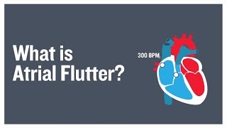 What is atrial flutter [upl. by Enelyt394]