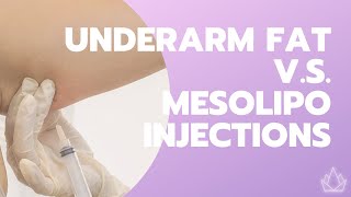 Melt Underarm Fat with Mesotherapy  O2 Skin Lab BGC [upl. by Witte156]