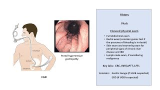 An Approach to GI Bleeding Melena Hematemesis Hematochezia [upl. by Yesoj]