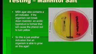 Introduction to Streptococcus [upl. by Lirbaj390]