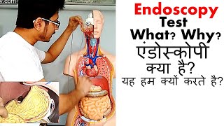 Endoscopy test in Hindi [upl. by Seaden]