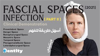 شرح مبسط  Fascial Spaces Infection  PART 22 [upl. by Yanahc]