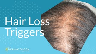 Common Hair Loss Triggers [upl. by Annatnas]