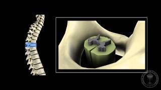 Neuroanatomy  The spinal cord [upl. by Chadbourne]