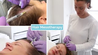 Hair Loss Mesotherapy  The Laser and Skin Clinic [upl. by Alwyn]