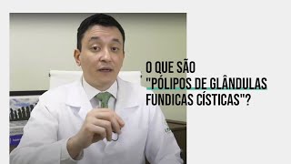 Pólipos de Glândulas Fúndicas Císticas [upl. by Anaujat]