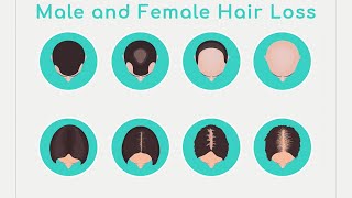 Hormone Replacement and Hair Loss [upl. by Manvel]