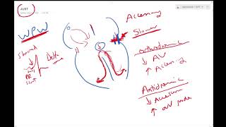 Atrioventricular reentrant tachycardia  Dr Jamal  ECG Lectures [upl. by Etteneg134]