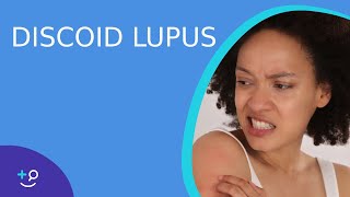 Discoid Lupus  Daily Dos of Dermatology [upl. by Ahen261]