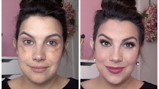 FULL COVERAGE Makeup for Melasma amp Discoloration [upl. by Notsgnal]