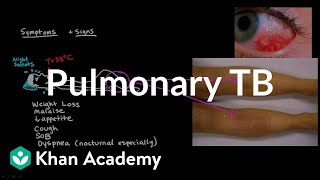 Pulmonary TB  Infectious diseases  NCLEXRN  Khan Academy [upl. by Ihsoyim]