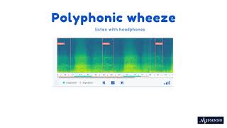 Lung sounds  polyphonic wheeze [upl. by Matland]