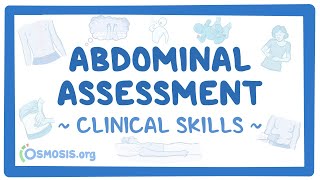 Abdominal Assessment Clinical Skills [upl. by Gruchot]