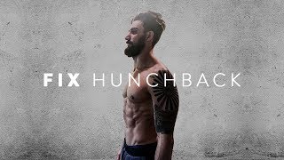 How to fix Hunchback Posture Kyphosis Exercises [upl. by Conal]