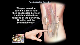 Pes Anserine Bursitis  Everything You Need To Know  Dr Nabil Ebraheim [upl. by Wivinah253]