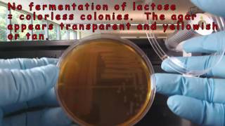 MacConkey Agar [upl. by Jorie]