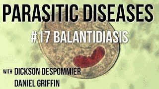 Parasitic Diseases Lectures 17 Balantidiasis [upl. by Enyamart]