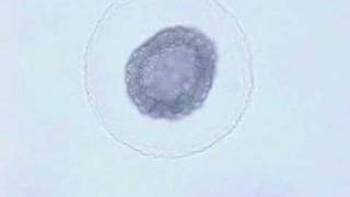 Amphioxus embryonic development [upl. by Elodia]