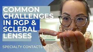 Specialty Contact Lenses Common Challenges [upl. by Elyag320]