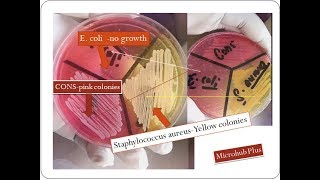 Mannitol salt agar  Staphylococcus aureus  MSA [upl. by Adlei]